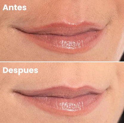 SilkyLips Depilador Facial Inalámbrico